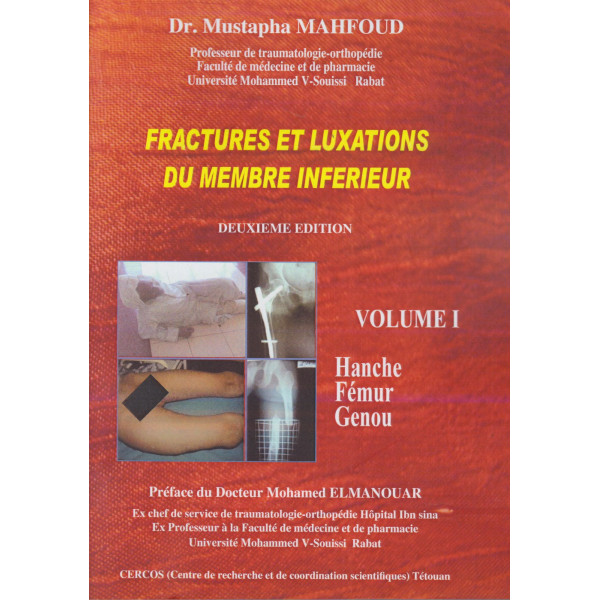 Fractures et luxations du membre inférieur V1+CD