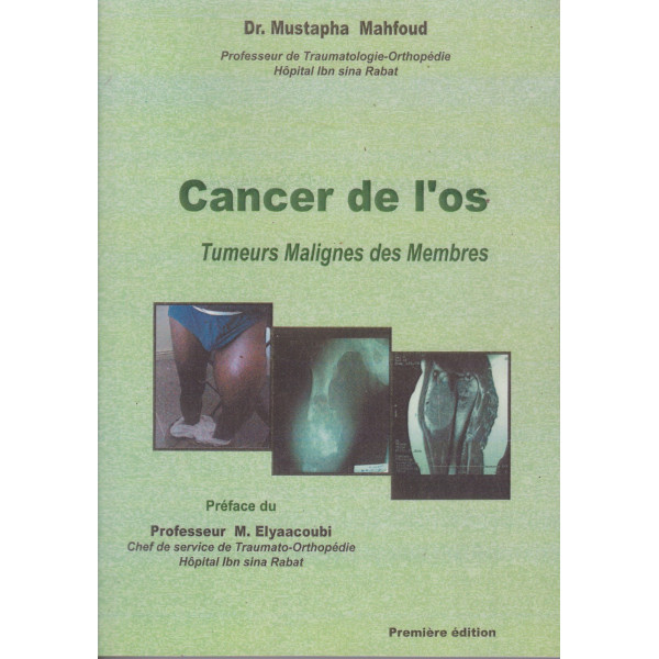 Cancer de L'os Tumeurs Malignes+CD