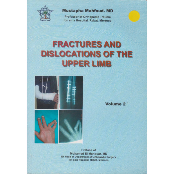 Fractures and dislocations of the upper V2