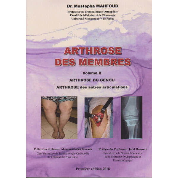 Arthrose des membres Fr/Ar 2018 T2