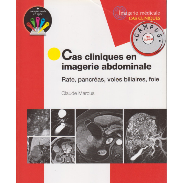 Cas cliniques en imagerie abdominale - Rate, pancréas, voies biliaires, foie Campus