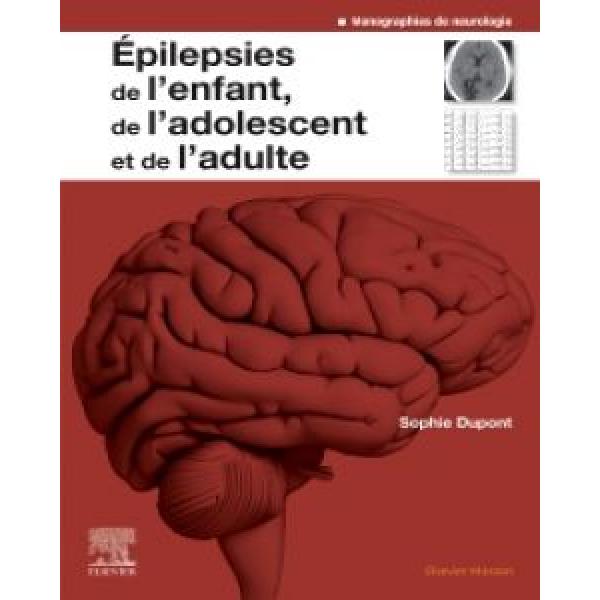 Epilepsies de l'enfant de l'adolescent et de l'adulte