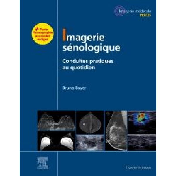 Imagerie sénologique - Conduites pratiques au quotidien