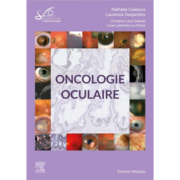 Oncologie oculaire