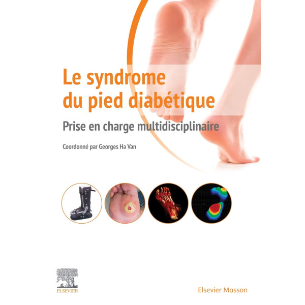 Le syndrome du pied diabétique: Prise en charge multidisciplinaire - Campus