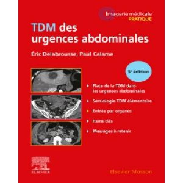 TDM des urgences abdominales 3éd
