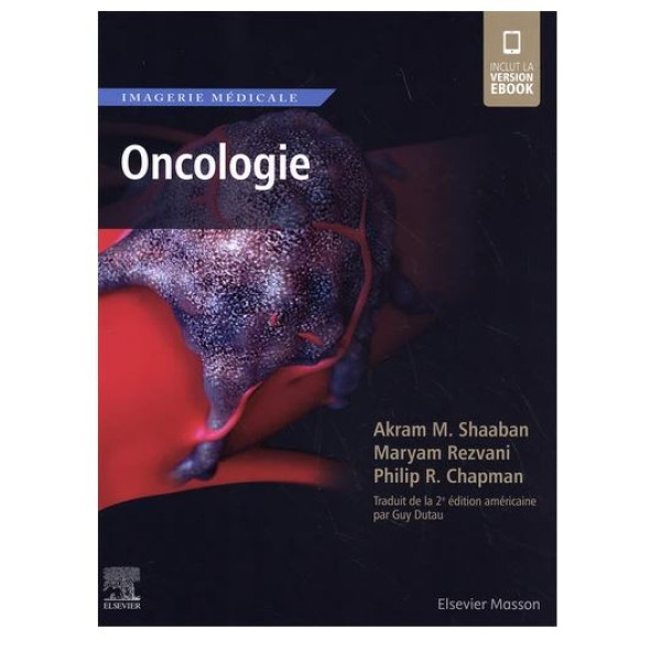 Oncologie.