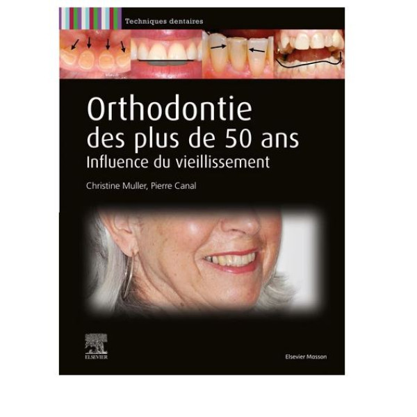 Orthodontie des plus de 50 ans