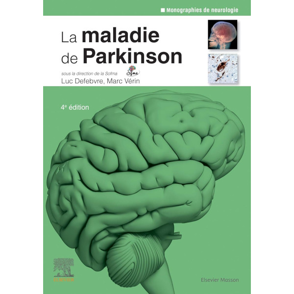 La maladie de Parkinson - Campus