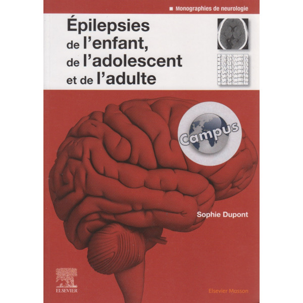 Epilepsies de l'enfant, de l'adolescent et de l'adulte (Campus)