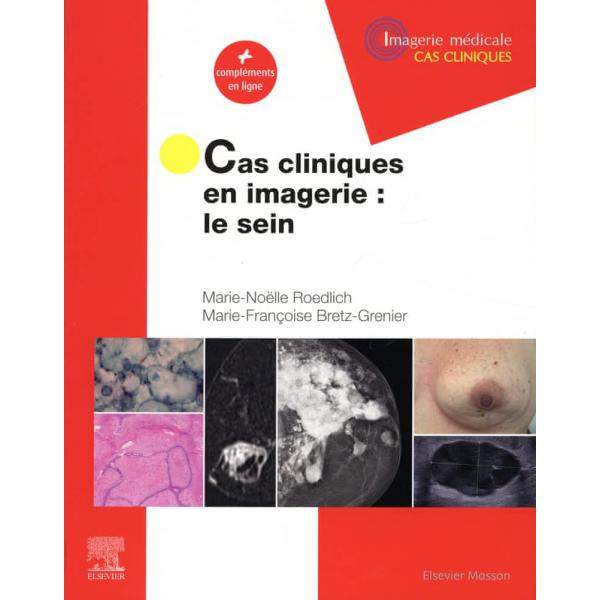 Cas cliniques en imagerie – Le sein -Campus 