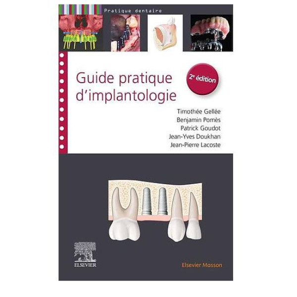 Guide pratique d'implantologie - campus