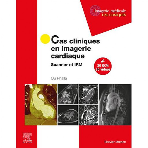 Cas cliniques en imagerie cardiaque - Scanner et IRM