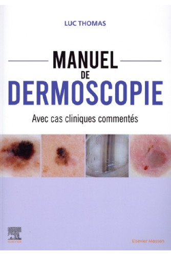 Manuel de dermoscopie. Avec cas cliniques commentés - Campus Manuel de dermoscopie. Avec cas cliniques commentés - Campus