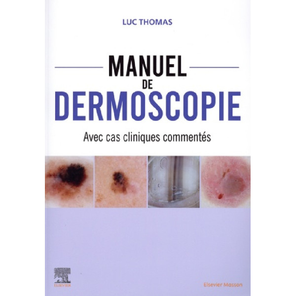 Manuel de dermoscopie. Avec cas cliniques commentés - Campus