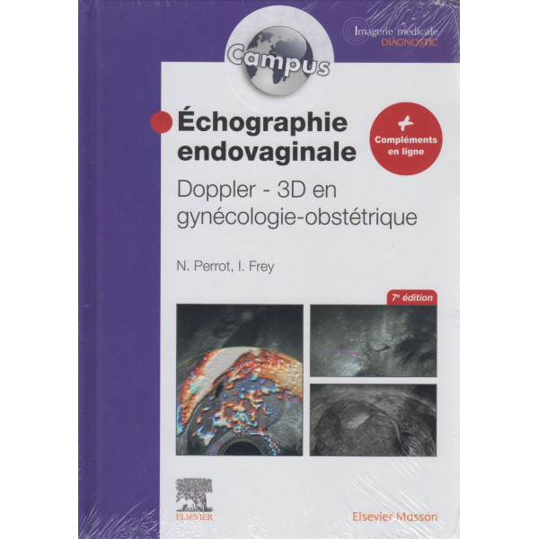 Échographie endovaginale Doppler - 3D (Campus)