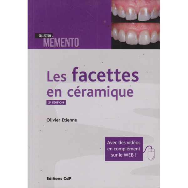 Les facettes en céramique 2ED