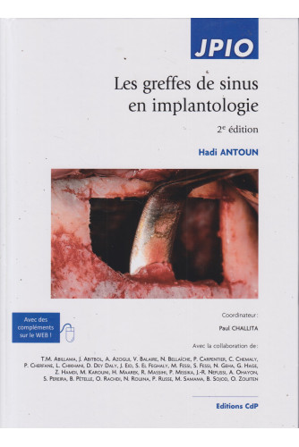 Les greffes de sinus en implantologie 2ED Les greffes de sinus en implantologie 2ED