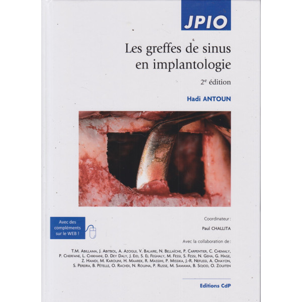 Les greffes de sinus en implantologie 2ED