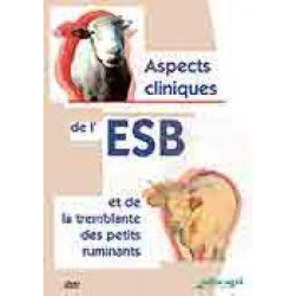 Aspects cliniques de l'ESB et de la