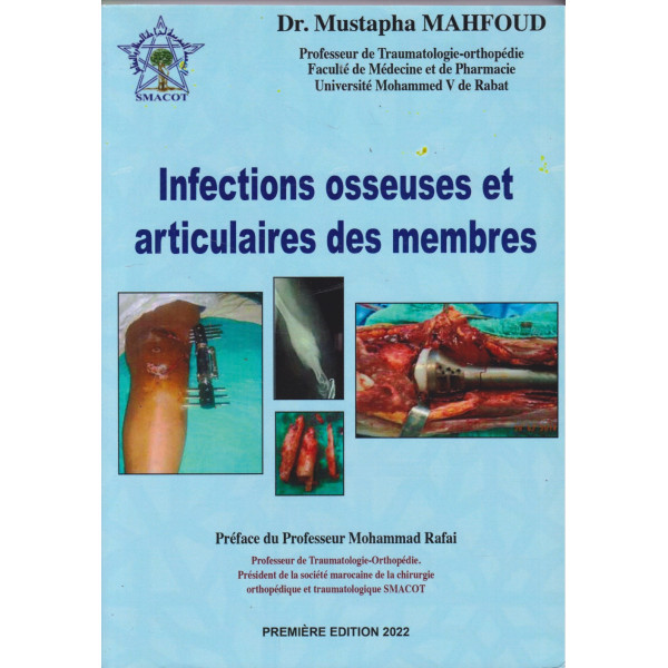 Infections osseuses et articulaires des membres