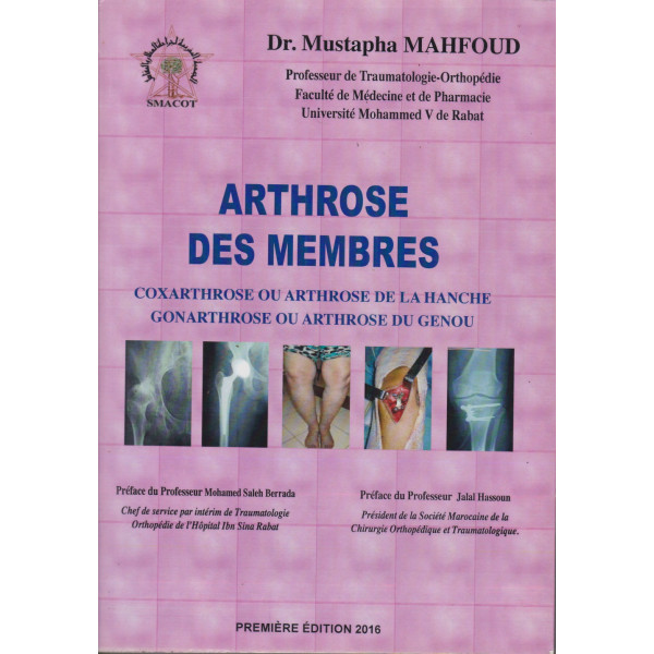 Arthrose des membres 2016